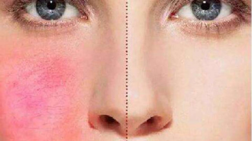最美人间四月天，赏花导致过敏？海洋物语不负春光不负你。