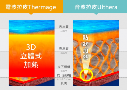拉皮科技再升级 爱尔丽凤凰电波智慧疗程让抗老更安全有效